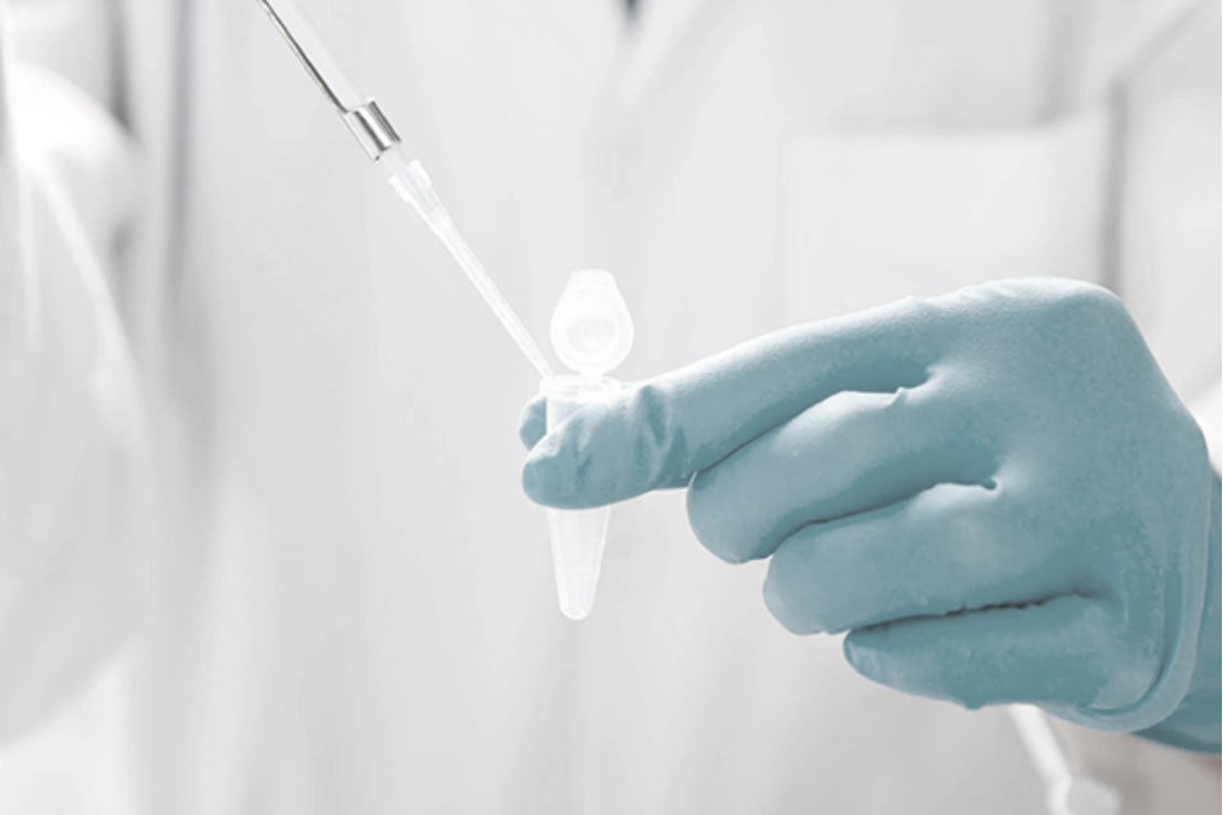 Laboratory professional wearing protective gloves and using a pipette to prepare a sample for molecular diagnostic testing